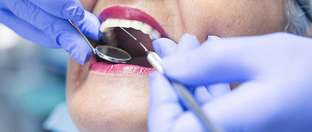 Best Emergency Dental Care for Broken or Chipped Teeth in Athena, OR